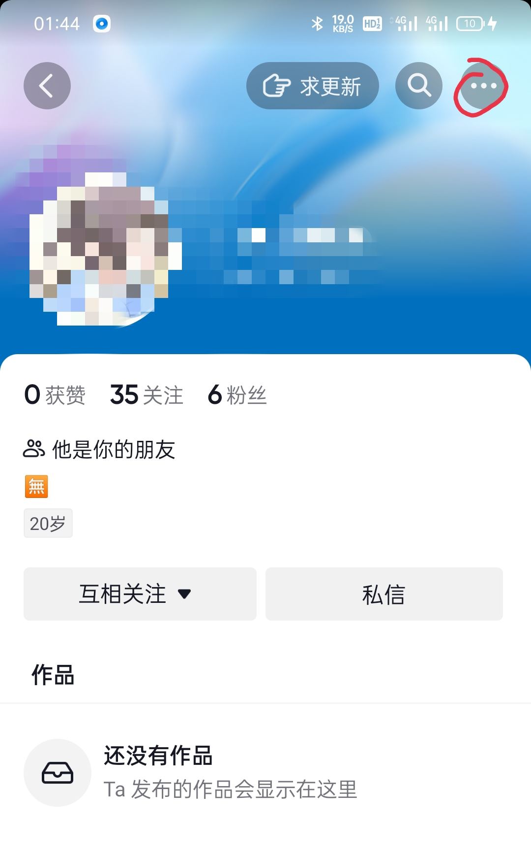 怎么移除抖音上面的朋友，對(duì)方會(huì)知道嗎？